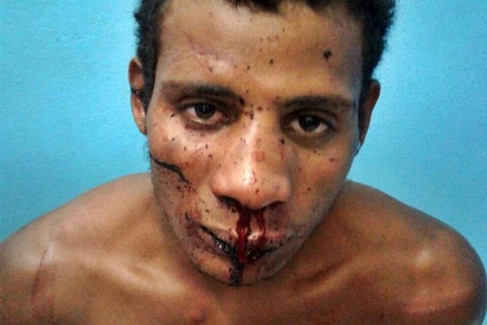 Por ciúmes, homem tenta assassinar esposa a facadas