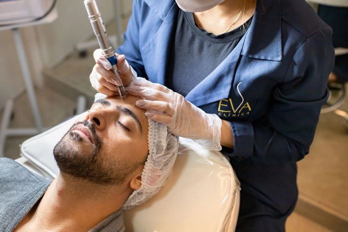 Conheça os benefícios do microagulhamento elétrico