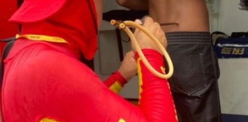 Jovem é atingido nas costas por arpão durante pesca submarina no Francês