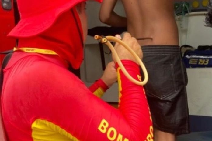 Jovem é atingido nas costas por arpão durante pesca submarina no Francês