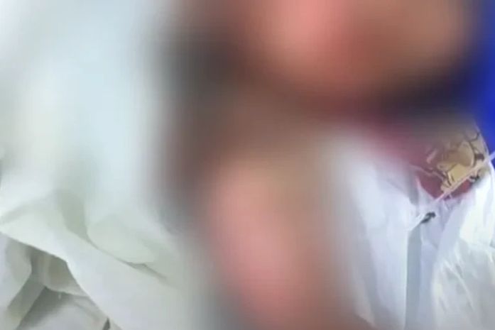 Homem é preso por atear fogo em companheira durante discussão por drogas em Maceió