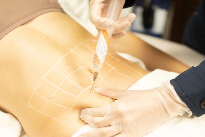 Gordura localizada: quais os tratamentos mais eficazes?