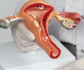 Santa Casa amplia assistência à saúde da mulher com exames para endometriose