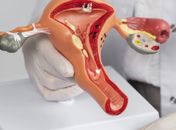 Santa Casa amplia assistência à saúde da mulher com exames para endometriose