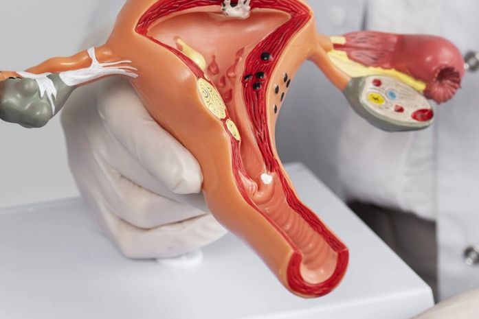 Santa Casa amplia assistência à saúde da mulher com exames para endometriose