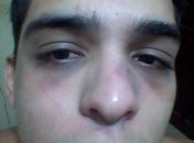 Estudante afirma ter sido espancado por militares do BOPE