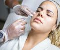 Preenchimento facial: Você conhece os diferentes tipos?