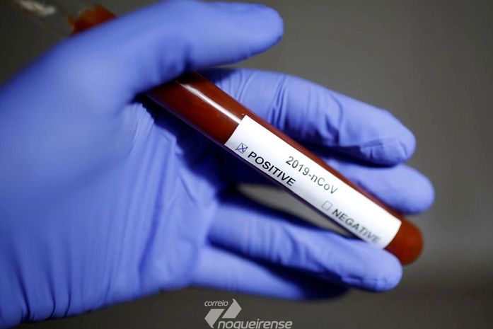 Brasil passa Itália em número de casos e já tem mais de 15 mil mortes