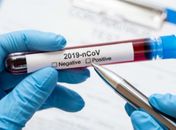 Taxa de infecção por covid-19 em Alagoas cai para 0,66; índice é o menor desde o início da pandemia