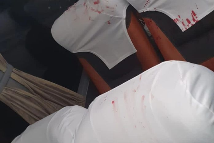 Ônibus do Bahia foi atacado