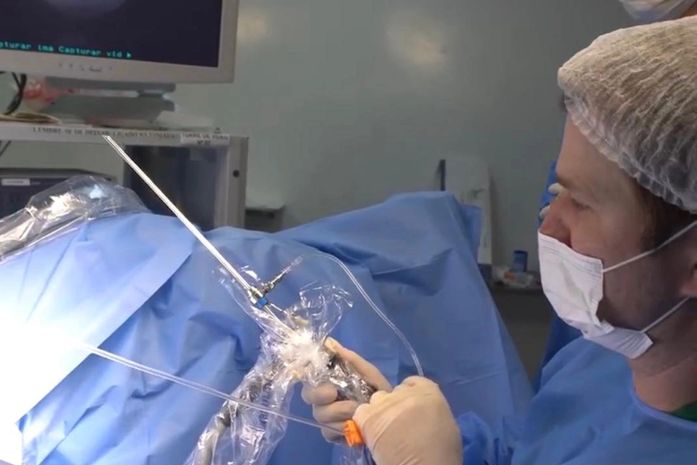 Histeroscopia: exame essencial na investigação e tratamento da infertilidade feminina