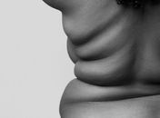 Gordofobia 