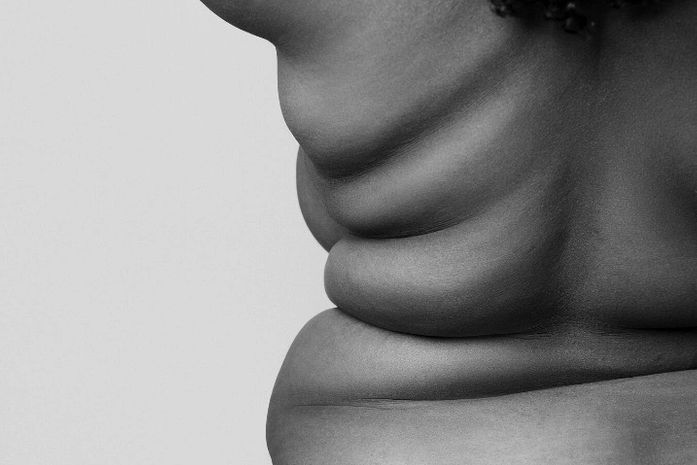 Gordofobia