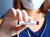 Alagoas confirma mais 869 casos de Covid-19 e número de infectados chega a 43.191