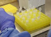 Covid-19: Brasil tem 1,3 mil mortes e 23,4 mil casos confirmados