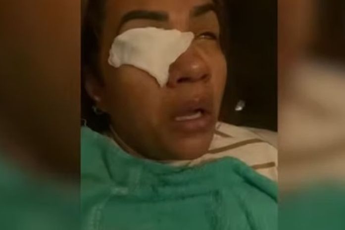 Mulher afirma ter ficado cega após usar produto de Virginia Fonseca
