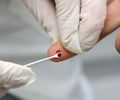 Haverá teste rápido para HIV