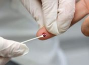 Haverá teste rápido para HIV, distribuição de preservativos e lubrificantes