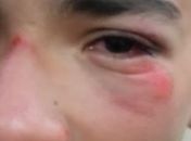 Mãe denuncia agressão contra filho por policiais do Bope durante prévias carnavalescas em Maceió