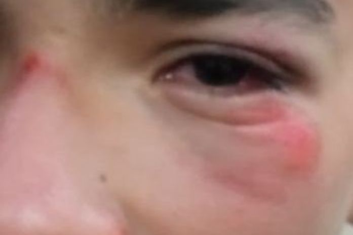 Mãe denuncia agressão contra filho por policiais do Bope durante prévias carnavalescas em Maceió