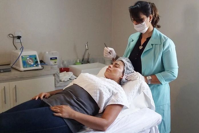 Já fiz minha primeira sessão de peeling