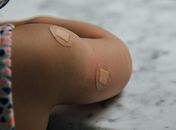 O recurso extraordinário, com repercussão geral, foi interposto por pais que, por seguirem a filosofia vegana, se contrapõem à vacinação.