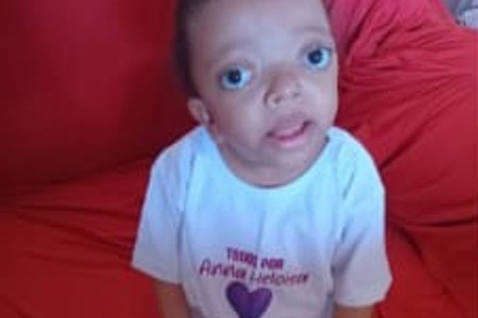 Família luta para arrecadar fundos para cirurgia de criança com craniossinostose