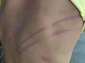 Criança apresentava marca agressão.