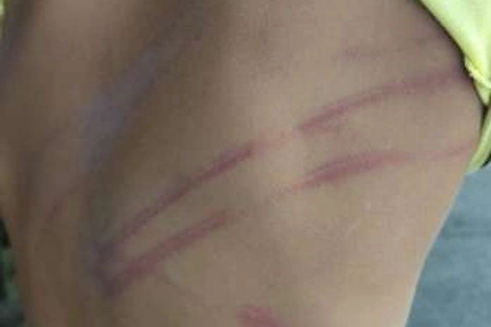 Criança apresentava marca agressão.