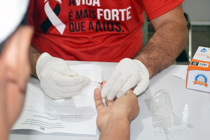 Alerta: após pandemia, casos graves de AIDS têm chegado com frequência ao Hospital Helvio Auto