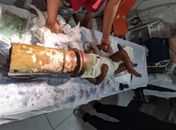 Criança prende cabeça em tubo de metal e Bombeiros são acionados para remover o objeto em Capela