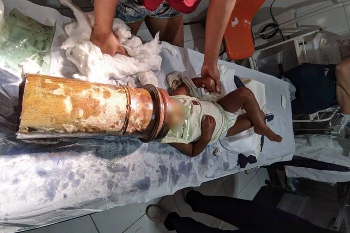 Criança prende cabeça em tubo de metal e Bombeiros são acionados para remover o objeto em Capela
