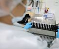 Fiocruz obtém patente para tratamento contra malária resistente com participação da UFAL