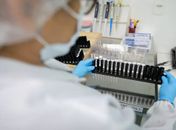 Fiocruz obtém patente para tratamento contra malária resistente com participação da UFAL