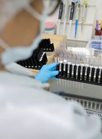 Fiocruz obtém patente para tratamento contra malária resistente com participação da UFAL