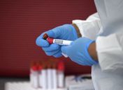 Alagoas confirma mais 215 casos de Covid-19; mulher de 37 anos está entre os 12 mortos pela doença