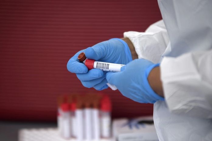 Alagoas confirma mais 215 casos de Covid-19; mulher de 37 anos está entre os 12 mortos pela doença