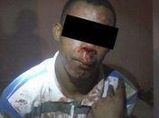 Motociclista reage e atropela menor durante tentativa de assalto