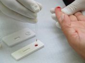 São Miguel dos Campos dispõe de teste rápido para HIV/Aids e Sífilis