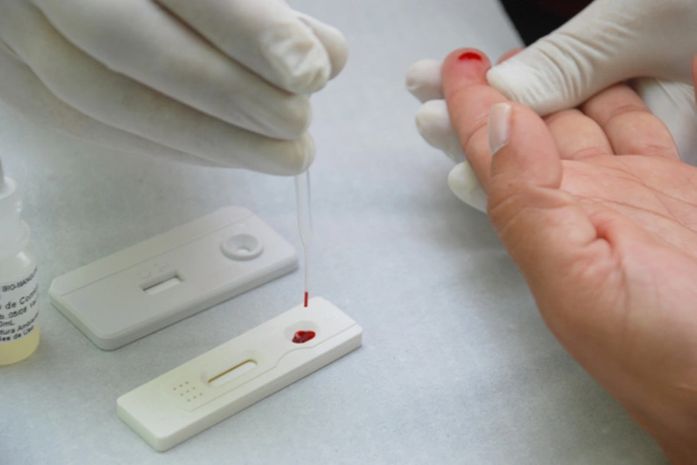 São Miguel dos Campos dispõe de teste rápido para HIV/Aids e Sífilis
