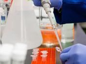 Caso suspeito de infecção por coronavírus é investigado em Arapiraca