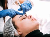 Bioestimuladores injetáveis de colágeno: o que preciso saber?