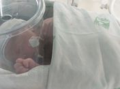 Maternidade Escola Santa Mônica realiza parto raro de gestação abdominal