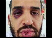 Infectologista foi espancado após defender lockdown 