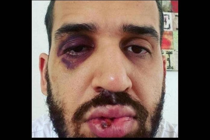 Infectologista foi espancado após defender lockdown