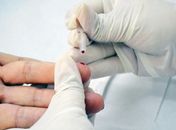Em combate às hepatites virais, Hospital Helvio Auto oferece testagem aberta à população