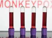 Primeiras vacinas contra varíola dos macacos devem chegar em setembro