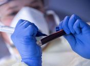 Arapiraca ultrapassa 300 mortes por Covid-19