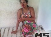 Grávida é ferida com golpes de barra de ferro ao tirar satisfações com amante do marido