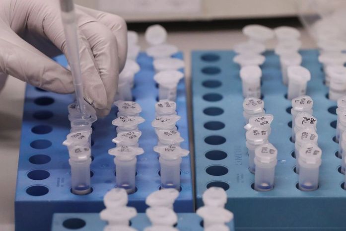 Laboratório descarta morte por coronavírus em Brasília